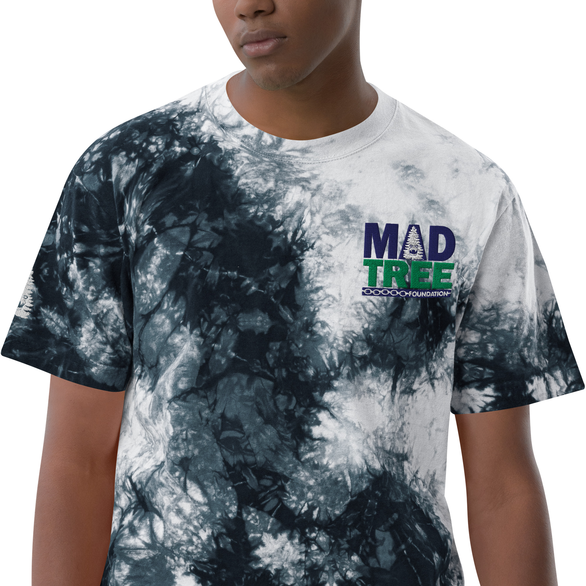 A person wears the Oversized tie-dye t-shirt in black and white, featuring “MAD TREE FOUNDATION” and a tree graphic on the left chest, standing against a plain background.